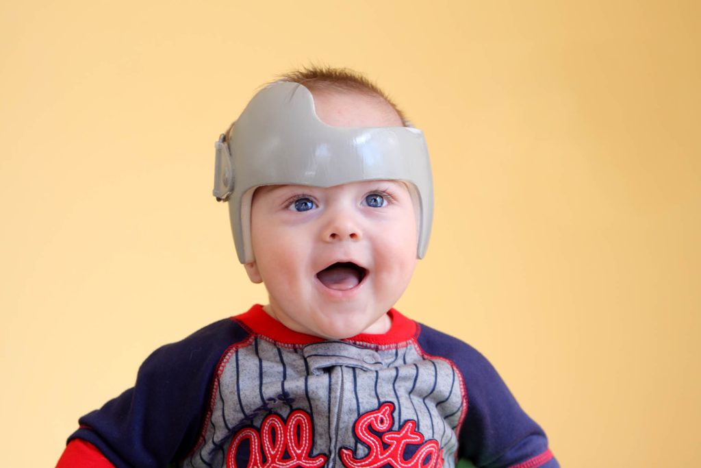 cranial remolding helmet