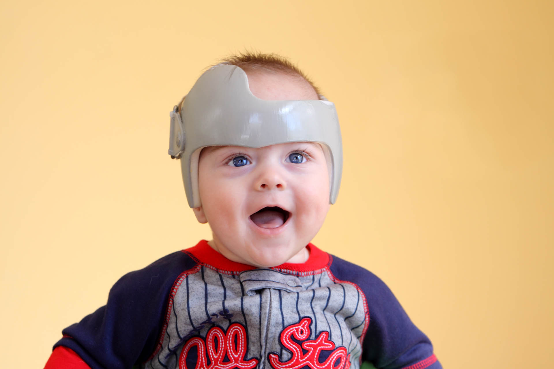 cranial remolding helmet